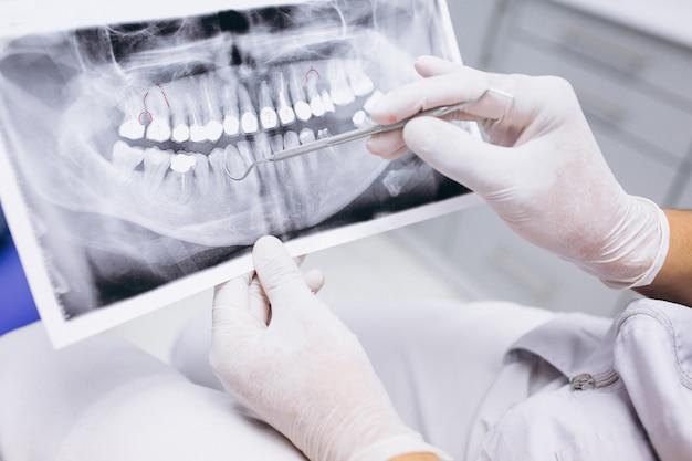 Kiedy potrzebne jest leczenie endodontyczne?