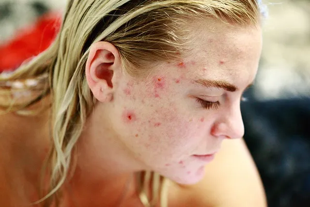 Wszystko o dermatologii — Sprawdź najważniejsze informacje!